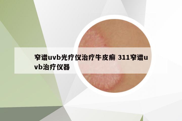 窄譜uvb光療儀治療牛皮癬 311窄譜uvb治療儀器