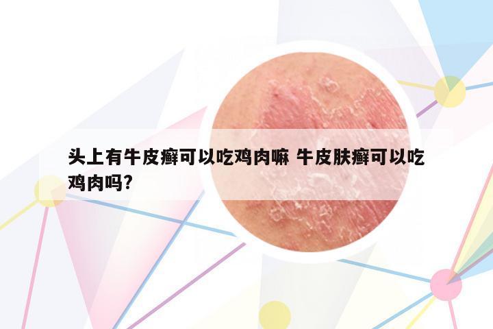 頭上有牛皮癬可以吃雞肉嘛 牛皮膚癬可以吃雞肉嗎?