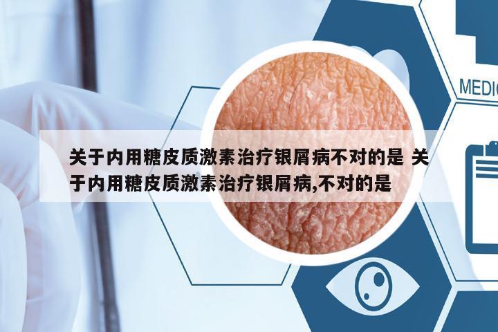 關于內(nèi)用糖皮質(zhì)激素治療銀屑病不對的是 關于內(nèi)用糖皮質(zhì)激素治療銀屑病,不對的是