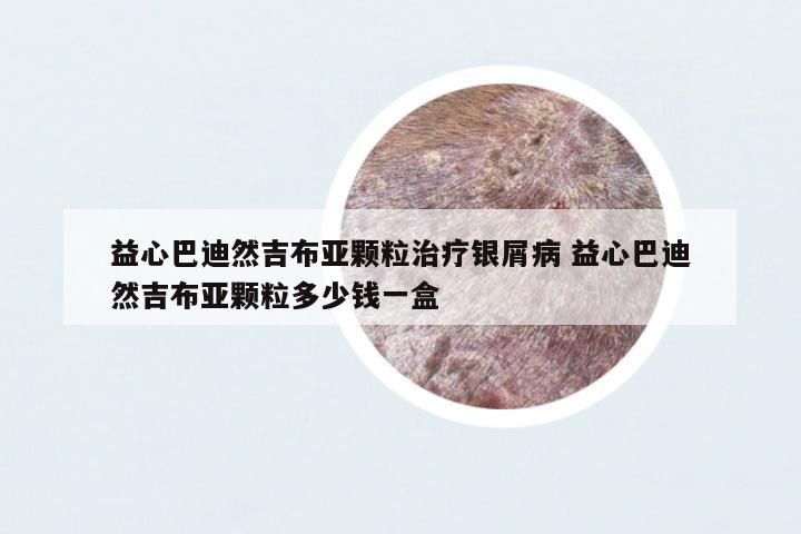 益心巴迪然吉布亞顆粒治療銀屑病 益心巴迪然吉布亞顆粒多少錢一盒