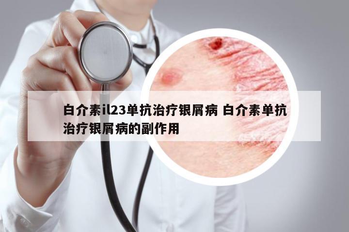 白介素il23單抗治療銀屑病 白介素單抗治療銀屑病的副作用