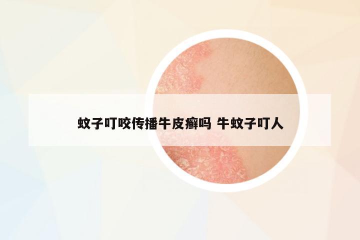 蚊子叮咬傳播牛皮癬嗎 牛蚊子叮人