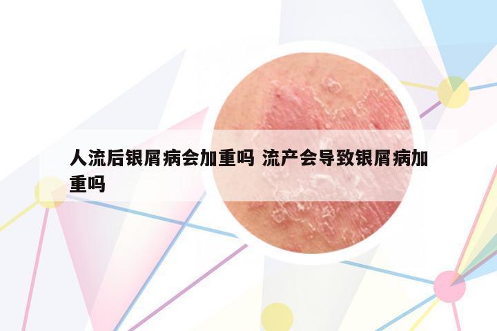 人流后銀屑病會加重嗎 流產(chǎn)會導(dǎo)致銀屑病加重嗎