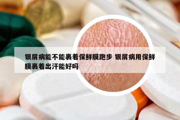 銀屑病能不能裹著保鮮膜跑步 銀屑病用保鮮膜裹著出汗能好嗎