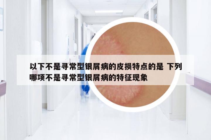 以下不是尋常型銀屑病的皮損特點(diǎn)的是 下列哪項(xiàng)不是尋常型銀屑病的特征現(xiàn)象