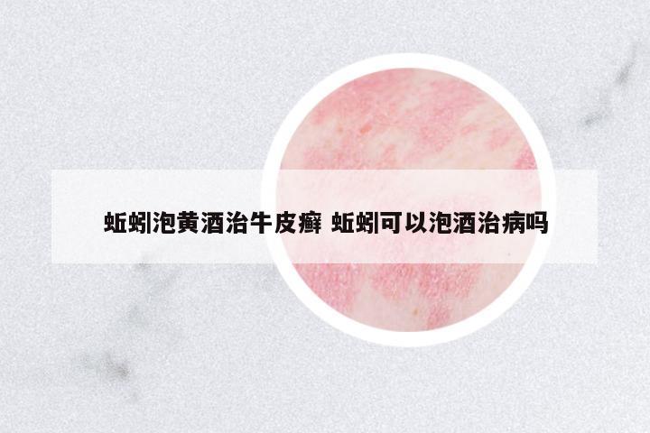 蚯蚓泡黃酒治牛皮癬 蚯蚓可以泡酒治病嗎