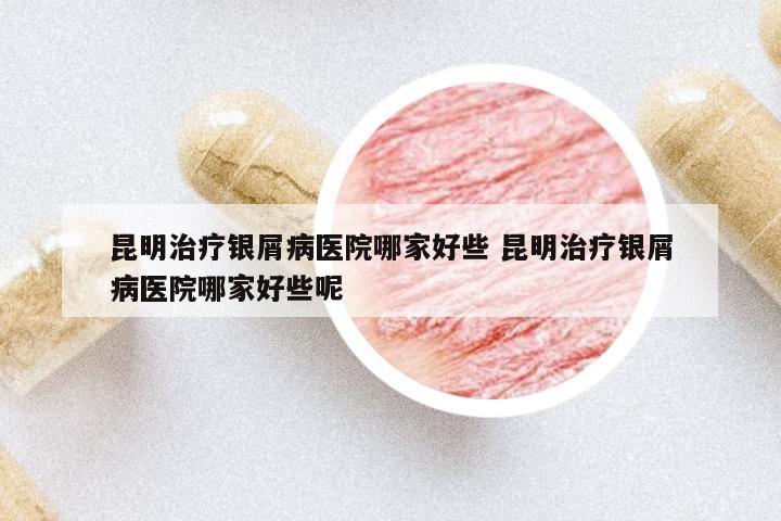 昆明治療銀屑病醫(yī)院哪家好些 昆明治療銀屑病醫(yī)院哪家好些呢