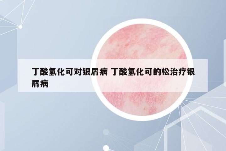 丁酸氫化可對銀屑病 丁酸氫化可的松治療銀屑病