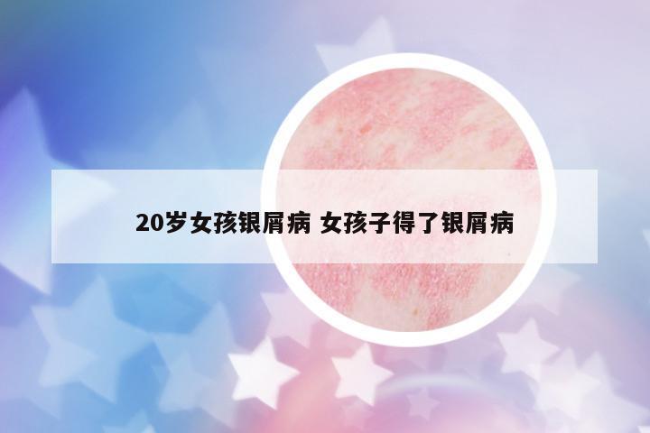 20歲女孩銀屑病 女孩子得了銀屑病