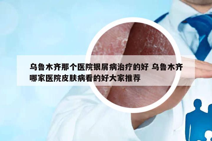 烏魯木齊那個醫(yī)院銀屑病治療的好 烏魯木齊哪家醫(yī)院皮膚病看的好大家推薦