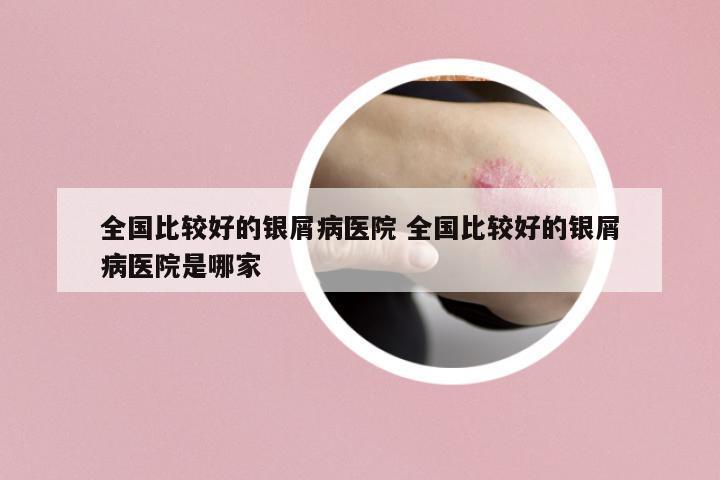 全國(guó)比較好的銀屑病醫(yī)院 全國(guó)比較好的銀屑病醫(yī)院是哪家