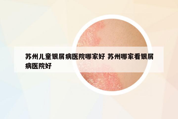 蘇州兒童銀屑病醫(yī)院哪家好 蘇州哪家看銀屑病醫(yī)院好