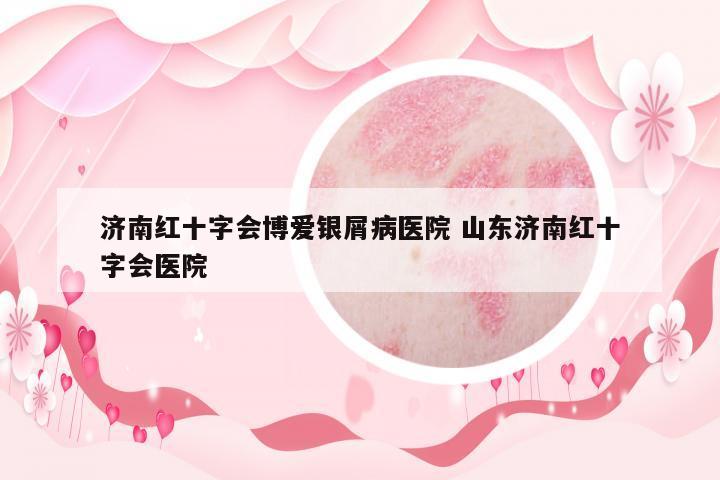 濟南紅十字會博愛銀屑病醫(yī)院 山東濟南紅十字會醫(yī)院