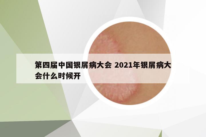 第四屆中國(guó)銀屑病大會(huì) 2021年銀屑病大會(huì)什么時(shí)候開