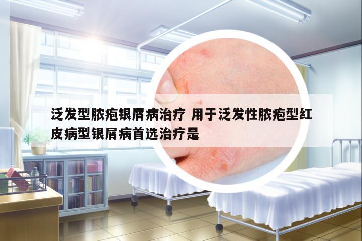 泛發(fā)型膿皰銀屑病治療 用于泛發(fā)性膿皰型紅皮病型銀屑病首選治療是