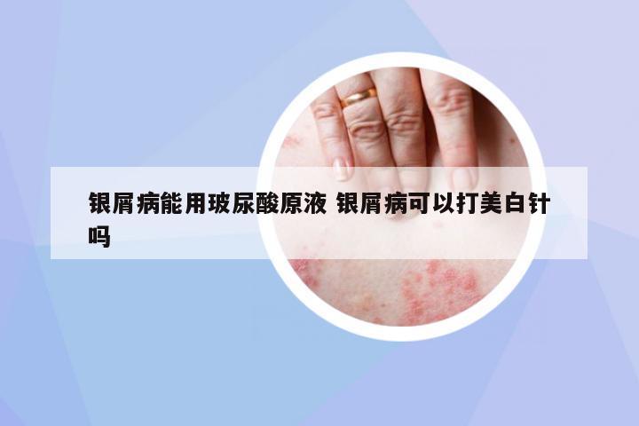銀屑病能用玻尿酸原液 銀屑病可以打美白針嗎