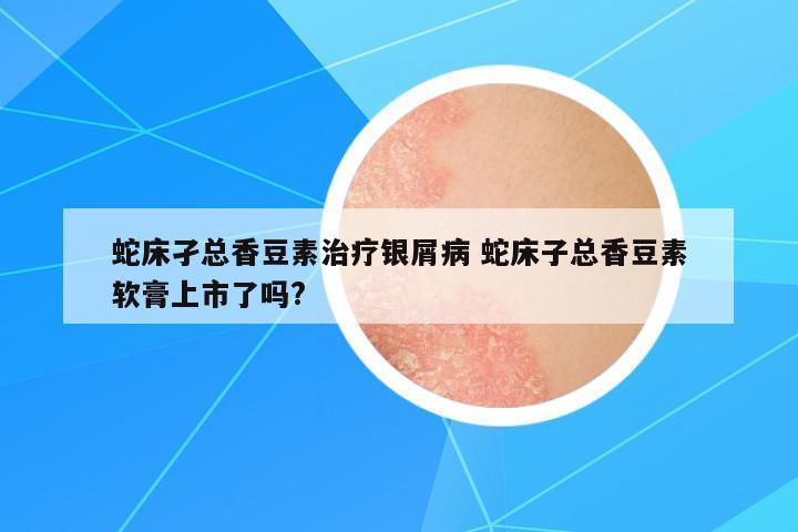 蛇床孑總香豆素治療銀屑病 蛇床子總香豆素軟膏上市了嗎?