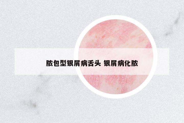 膿包型銀屑病舌頭 銀屑病化膿