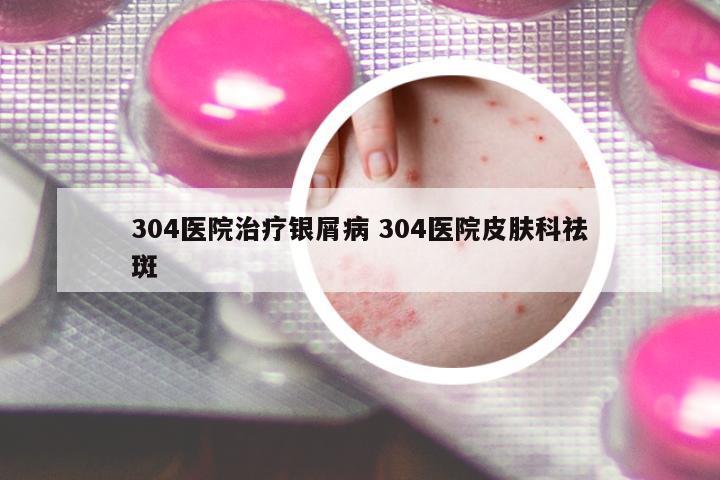 304醫(yī)院治療銀屑病 304醫(yī)院皮膚科祛斑
