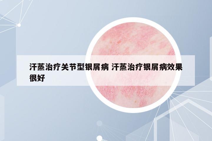 汗蒸治療關(guān)節(jié)型銀屑病 汗蒸治療銀屑病效果很好