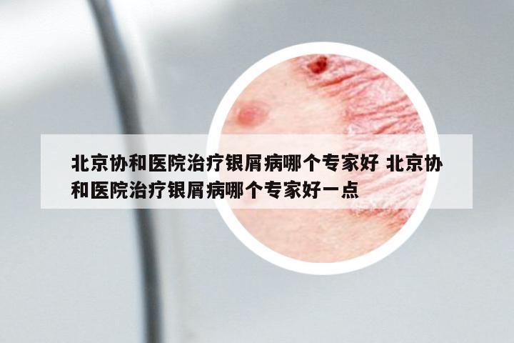 北京協(xié)和醫(yī)院治療銀屑病哪個專家好 北京協(xié)和醫(yī)院治療銀屑病哪個專家好一點