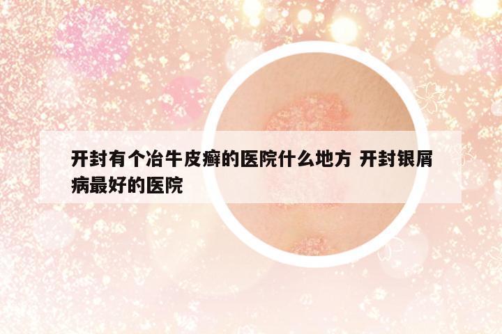 開封有個冶牛皮癬的醫(yī)院什么地方 開封銀屑病最好的醫(yī)院
