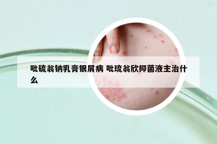 吡硫翁鈉乳膏銀屑病 吡琉翁欣抑菌液主治什么