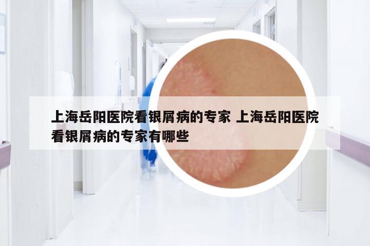 上海岳陽醫(yī)院看銀屑病的專家 上海岳陽醫(yī)院看銀屑病的專家有哪些