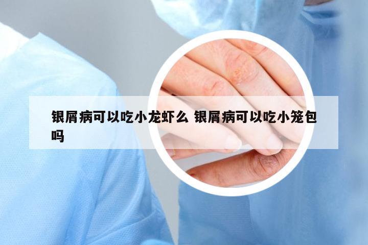 銀屑病可以吃小龍蝦么 銀屑病可以吃小籠包嗎