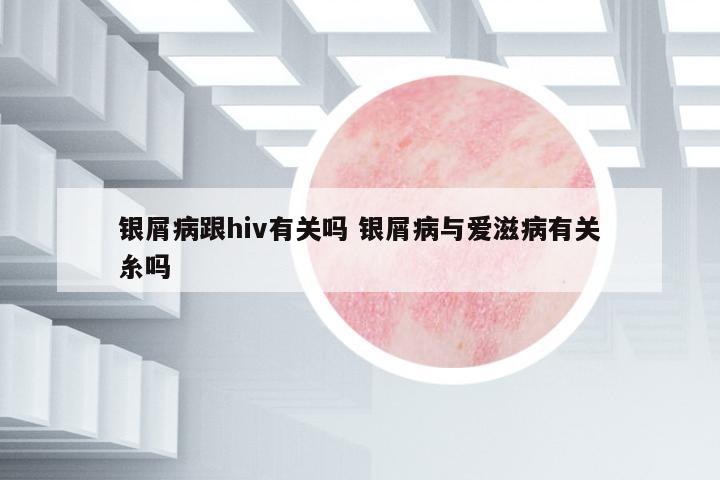 銀屑病跟hiv有關(guān)嗎 銀屑病與愛(ài)滋病有關(guān)糸嗎