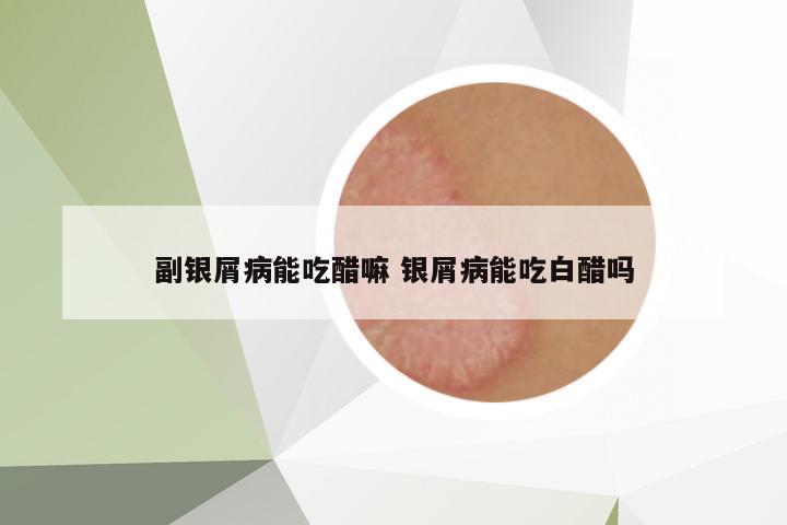 副銀屑病能吃醋嘛 銀屑病能吃白醋嗎