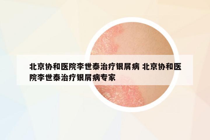北京協(xié)和醫(yī)院李世泰治療銀屑病 北京協(xié)和醫(yī)院李世泰治療銀屑病專家