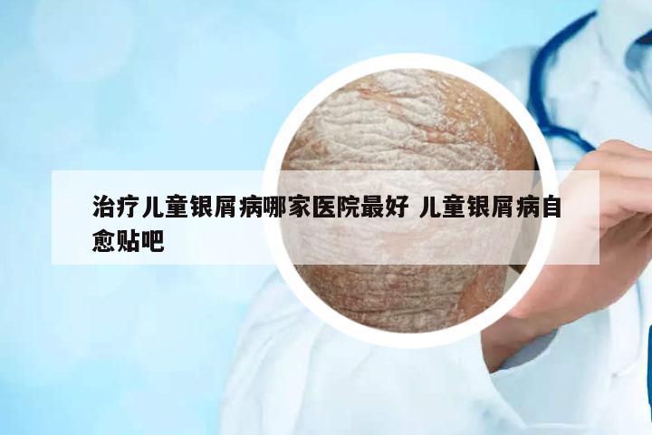 治療兒童銀屑病哪家醫(yī)院最好 兒童銀屑病自愈貼吧