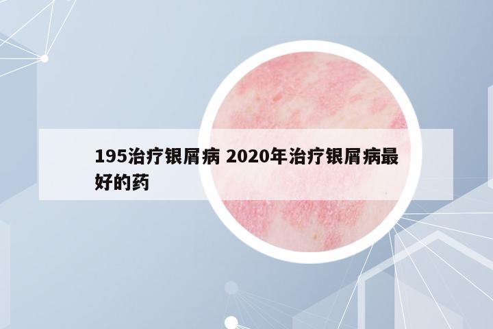 195治療銀屑病 2020年治療銀屑病最好的藥
