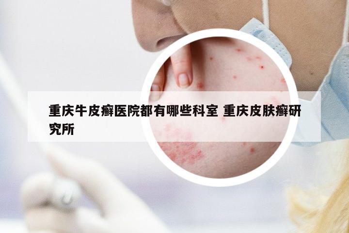 重慶牛皮癬醫(yī)院都有哪些科室 重慶皮膚癬研究所