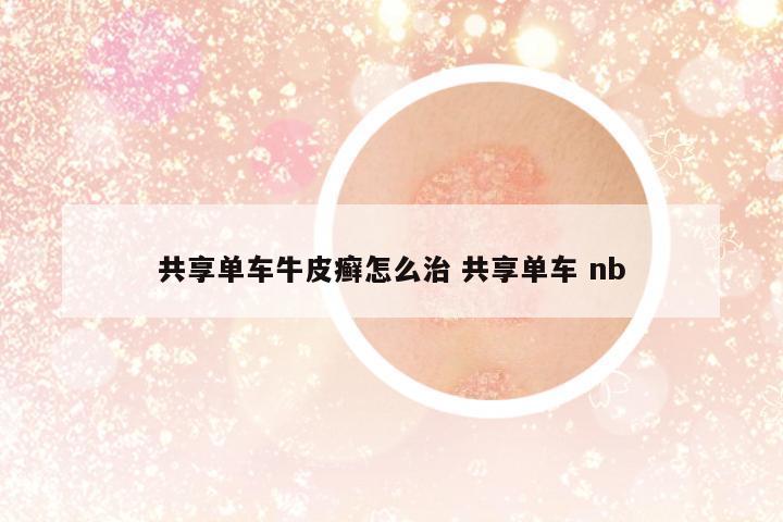 共享單車牛皮癬怎么治 共享單車 nb