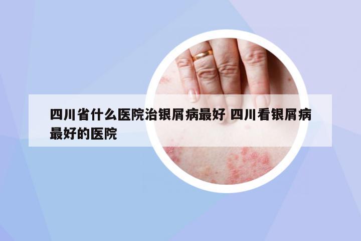 四川省什么醫(yī)院治銀屑病最好 四川看銀屑病最好的醫(yī)院