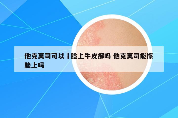 他克莫司可以抺臉上牛皮癬嗎 他克莫司能擦臉上嗎