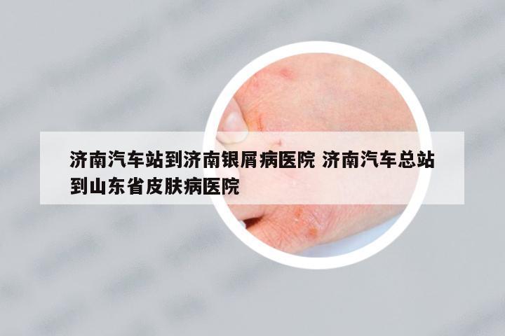 濟(jì)南汽車站到濟(jì)南銀屑病醫(yī)院 濟(jì)南汽車總站到山東省皮膚病醫(yī)院