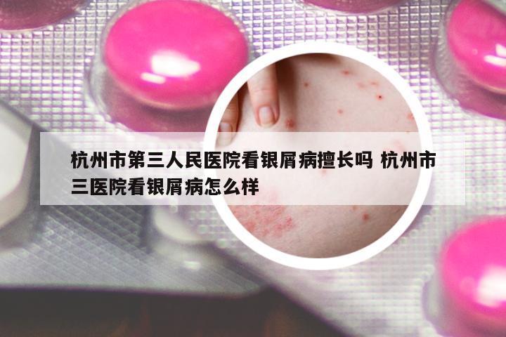 杭州市第三人民醫(yī)院看銀屑病擅長嗎 杭州市三醫(yī)院看銀屑病怎么樣