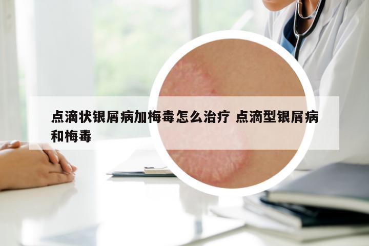 點滴狀銀屑病加梅毒怎么治療 點滴型銀屑病和梅毒