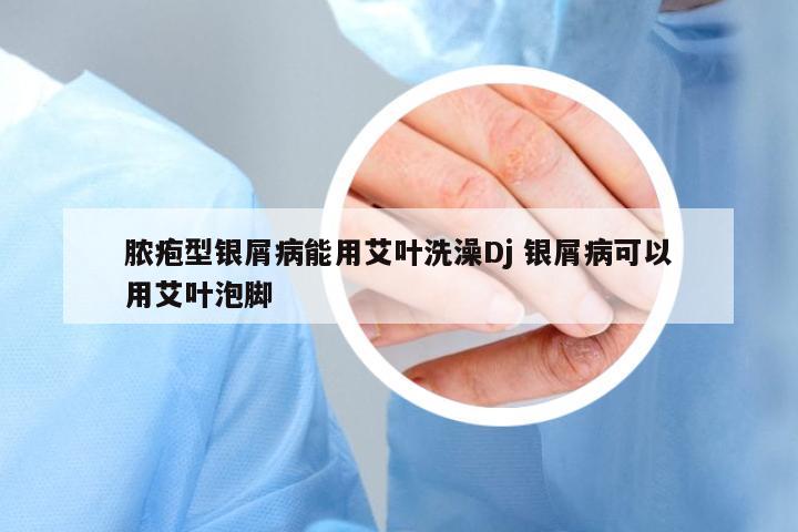 膿皰型銀屑病能用艾葉洗澡Dj 銀屑病可以用艾葉泡腳