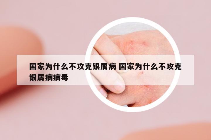 國家為什么不攻克銀屑病 國家為什么不攻克銀屑病病毒