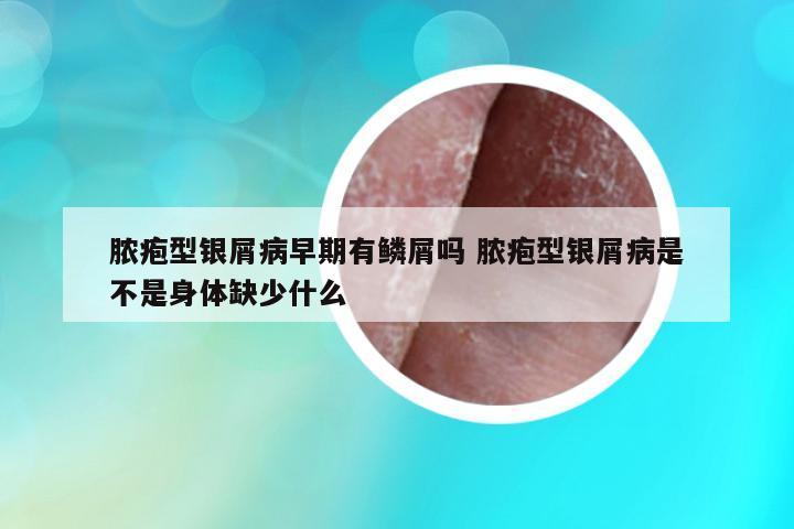 膿皰型銀屑病早期有鱗屑嗎 膿皰型銀屑病是不是身體缺少什么