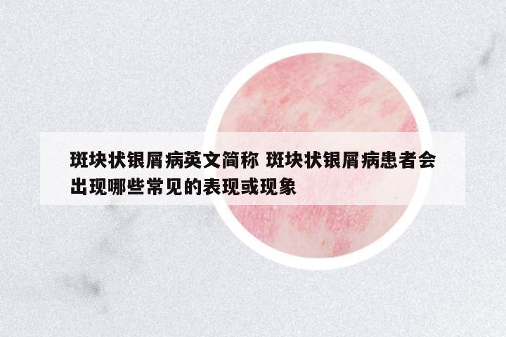 斑塊狀銀屑病英文簡稱 斑塊狀銀屑病患者會出現(xiàn)哪些常見的表現(xiàn)或現(xiàn)象