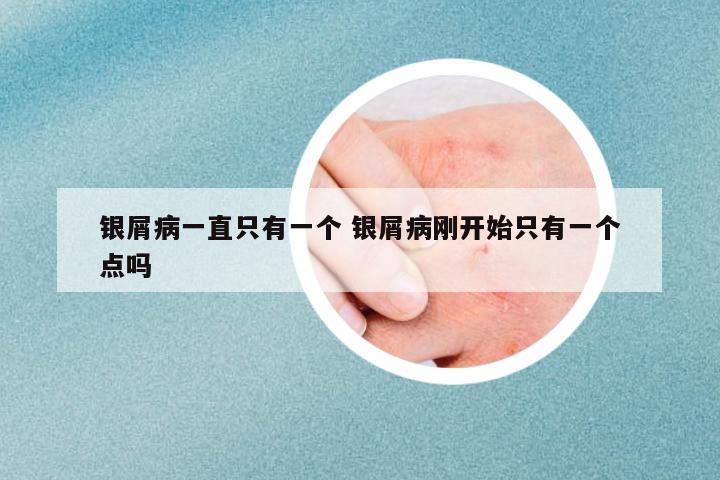 銀屑病一直只有一個(gè) 銀屑病剛開始只有一個(gè)點(diǎn)嗎