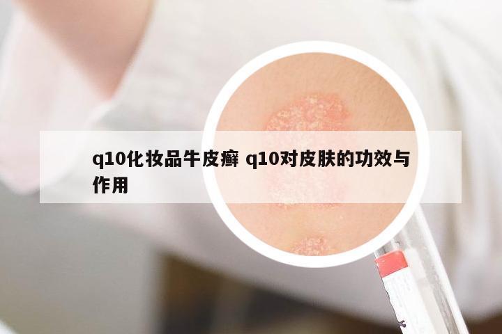 q10化妝品牛皮癬 q10對皮膚的功效與作用