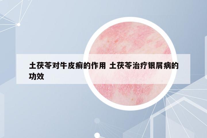 土茯苓對牛皮癬的作用 土茯苓治療銀屑病的功效