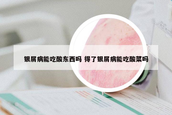 銀屑病能吃酸東西嗎 得了銀屑病能吃酸菜嗎