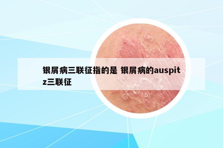 銀屑病三聯(lián)征指的是 銀屑病的auspitz三聯(lián)征